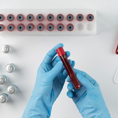 First-in-human clinical trial confirms novel HIV vaccine approach developed by IAVI and Scripps Research