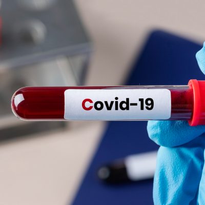 Individual COVID-19 infections include multiple variants of the SARS-CoV-2 virus, research shows