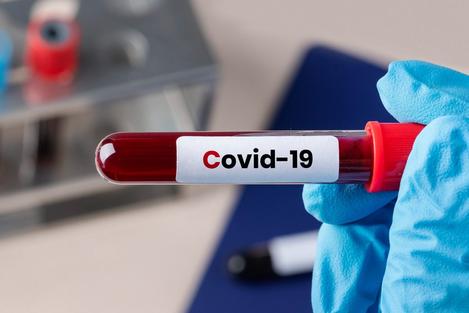 Individual COVID-19 infections include multiple variants of the SARS-CoV-2 virus, research shows
