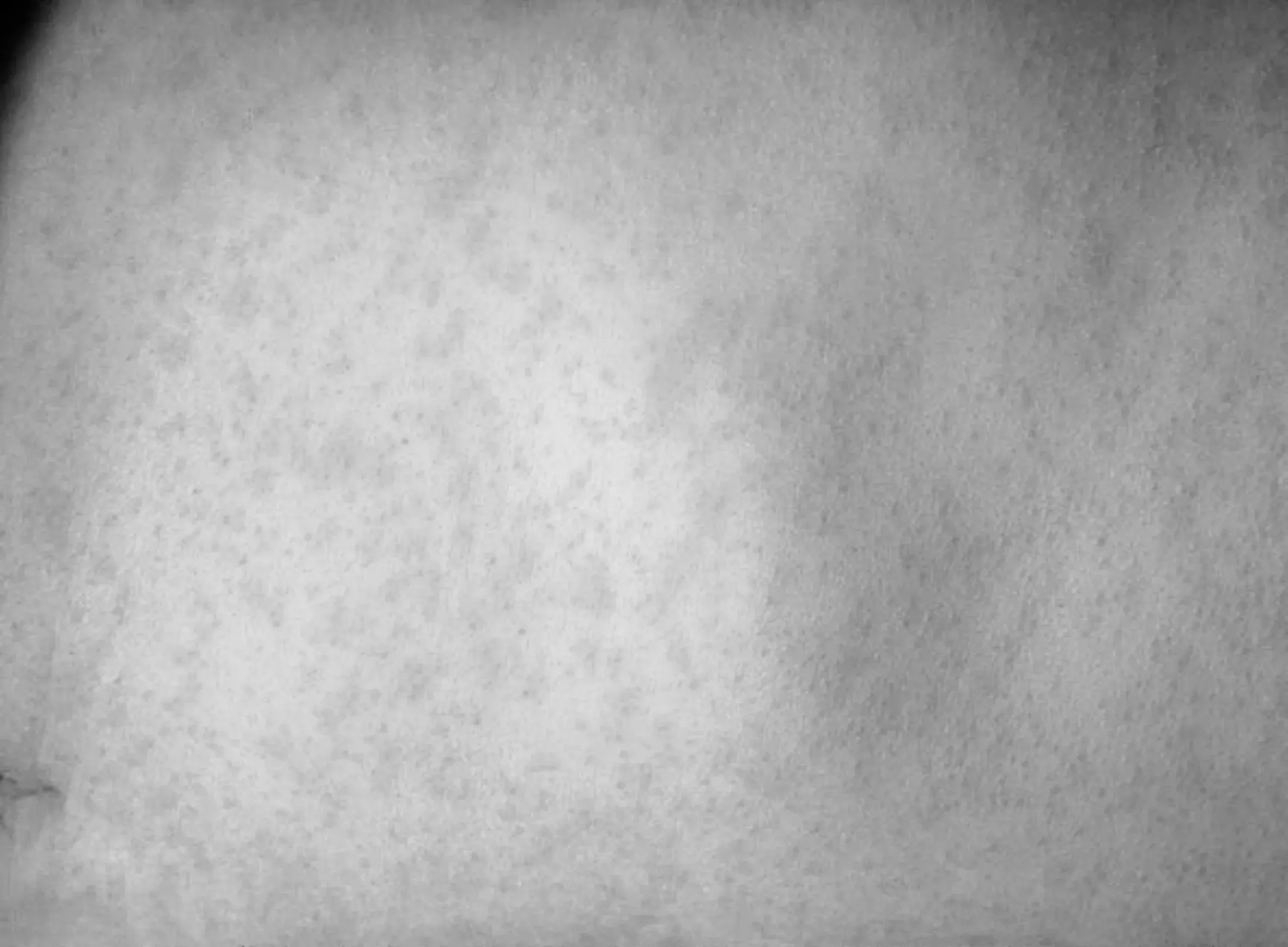 We know how to stop measles. so why is it back?